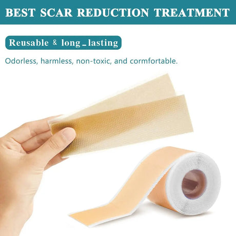 4cm X 150cm Silicone Scar Sheets , 1 Roll Self-Adhesive Scar Cover Tape Skin Care Waterproof and Breathable Scar Patch