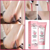 Body Whitening Cream Dark Skin Armpit Lightening Intimate Areas Underarm Bleaching Private Parts Whiten Cream Body Lotion Beauty