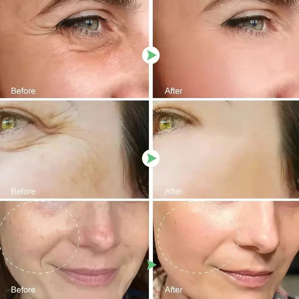 Facial Retinol Serum Whitening Moisturising Fade Fine Lines Anti Wrinkle Anti Ageing Rejuvenate Your Face Korean Cosmetics 30ml