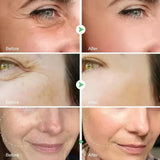Facial Retinol Serum Whitening Moisturising Fade Fine Lines Anti Wrinkle Anti Ageing Rejuvenate Your Face Korean Cosmetics 30ml