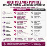Multi-Collagen Peptides Powder – Hydrolyzed Collagen Blend with Vitamin C & Biotin Supports Skin,Hair and Nail  Health 454g/1lb
