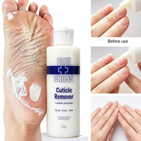30/177/473Ml Nail Cuticle Removal Gel Cream Foot Cuticle Remove Soften Dead Skin Foot Exfoliation Softener