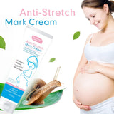Snail Removes Stretch Mark Cream To Remove Postpartum Obesity Pregnant Women Repair Anti-Aging Anti-Winkles Firming Body Cream