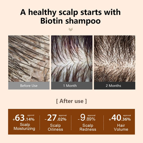 PURC Biotin Hair Shampoo Conditioner for Men Women Scalp Cleaning Hair Root Nourish Oil Smoothing Hair Mask Care Products Set