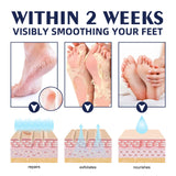 Anti Crack Cream Heel Chapping Repair Dead Skin Removal Anti-Drying Hand Treatment Nourishing Foot Dryness Cracked Repair Cream