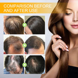 EELHOE Biotin Hair Spray For Man Women 30ml Hair Growth Repair Damage Restore Oil Scalp Repair Serum Spray Thicken Hair Care