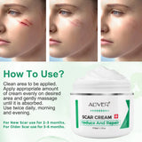ALVER Acne Scar Stretch Marks Remover Cream Skin Repair Acne Black Dots Spots Acne Treatment Blackhead Bleaching Cream 50ml