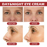 Mess-Free Retinol Eye Cream Stick-Retinol For Wrinkle Smoothing,Multi-Use Balm for Facial Fine Lines&Perfect Overnight Age-Defying Balm