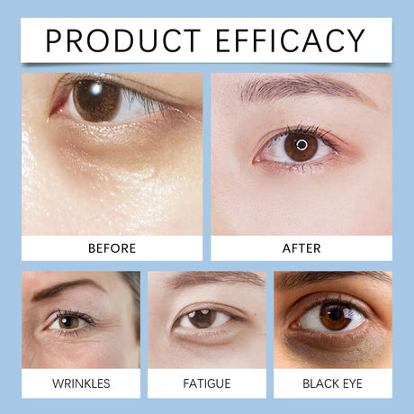 Hydrating Eye Cream,Fade Dark Circles Powerfully,Collagen Smooths Crow  Feet,Deeply Hydrate & Lock Moisture,Anti Aging Against Photoaging,De Puffs & Refreshes Tired Eyes,Milia Free Lightweight Texture,Vegan & Cruelty Free