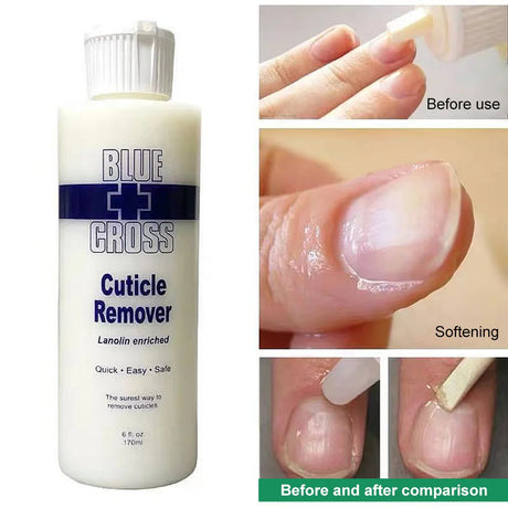30/177/473Ml Nail Cuticle Removal Gel Cream Foot Cuticle Remove Soften Dead Skin Foot Exfoliation Softener